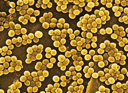 金黃色葡萄球菌單克隆抗體